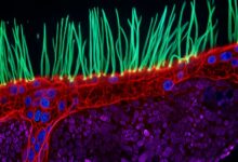 thumbnail-nikon-small-world-comp